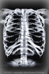 Skeleton X-Ray 2" X 3" Magnet